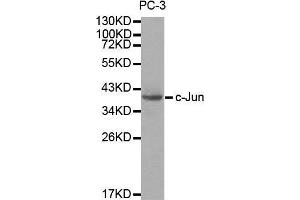 Western blot analysis of extracts of PC3 cells, using c-Jun antibody. (C-JUN anticorps  (AA 1-70))