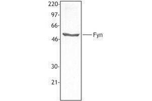 Western Blotting (WB) image for anti-FYN Oncogene Related To SRC, FGR, YES (FYN) antibody (ABIN2666047) (FYN anticorps)