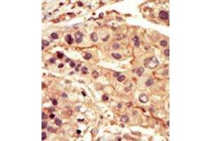 Image no. 1 for anti-Src-Related Kinase Lacking C-Terminal Regulatory Tyrosine and N-Terminal Myristylation Sites (SRMS) (C-Term) antibody (ABIN359994)