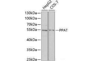 Western blot analysis of extracts of various cell lines using PPAT Polyclonal Antibody at dilution of 1:1000. (PPAT anticorps)