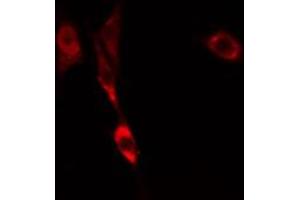ABIN6274817 staining COLO205 cells by IF/ICC. (ARF6 anticorps  (Internal Region))