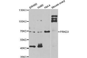 Western blot analysis of extracts of various cell lines, using PRKD3 antibody. (PRKD3 anticorps)