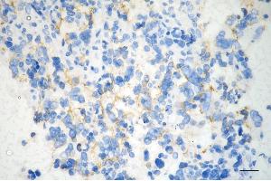 anti-Asparaginase Like 1 (ASRGL1) antibody