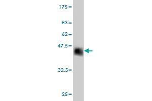 Western Blot detection against Immunogen (37. (ZNF41 anticorps  (AA 221-321))