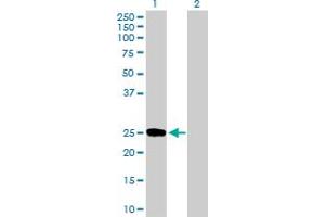 Western Blot analysis of DUSP19 expression in transfected 293T cell line by DUSP19 MaxPab polyclonal antibody. (DUSP19 anticorps  (AA 1-217))