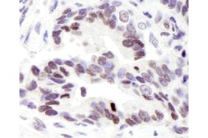 Immunohistochemistry (IHC) image for anti-PYD (Pyrin Domain) Containing 1 (PYDC1) (C-Term) antibody (ABIN7448421)