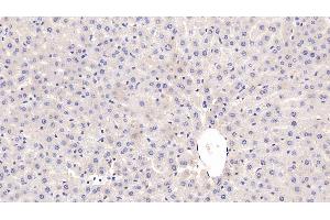 Detection of CRP in Rat Liver Tissue using Monoclonal Antibody to C Reactive Protein (CRP)