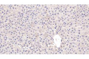 Detection of CRP in Rat Liver Tissue using Monoclonal Antibody to C Reactive Protein (CRP) (CRP anticorps  (AA 20-230))