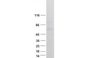 Validation with Western Blot