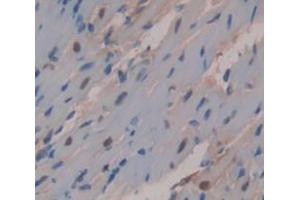 Used in DAB staining on fromalin fixed paraffin- embedded Kidney tissue