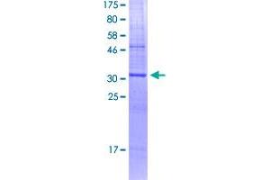 Image no. 1 for EPH Receptor A4 (EPHA4) (AA 1-105) protein (GST tag) (ABIN2565165)