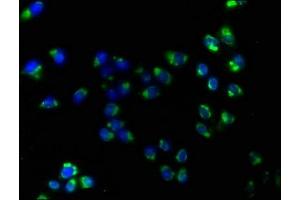 Immunofluorescence staining of Hela cells with ABIN7170052 at 1:160, counter-stained with DAPI. (ATP1B3 anticorps  (AA 57-279))