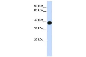 Western Blotting (WB) image for anti-Sphingolipid Delta(4)-Desaturase DES1 (DEGS1) antibody (ABIN2458939) (DEGS1 anticorps)