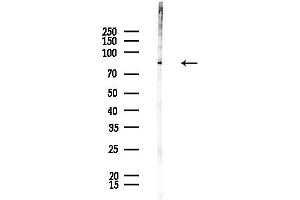 Western blot analysis of lysates from Rat brain, using MAN1 Antibody at 1/1000 dilution.