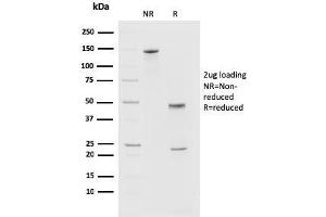 SDS-PAGE Analysis of Purified PD1 (CD279) Mouse Monoclonal Antibody (PDCD1/2720).