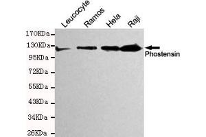 Western blot detection of Phostensin in Hela,Raji,Ramos and Leucocyte cell lysates and using Phostensin mouse mAb (1:200 diluted). (KIAA1949 anticorps)