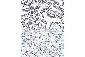 Immunohistochemical staining (Formalin-fixed paraffin-embedded sections) of (A) human lung and (B) human heart tissues with LHX3 polyclonal antibody . (LHX3 anticorps  (Internal Region))