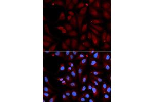 Immunofluorescence analysis of U2OS cell using MAOB antibody.