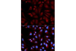 Immunofluorescence analysis of U2OS cell using MAOB antibody. (Monoamine Oxidase B anticorps  (AA 1-260))