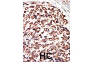 Immunohistochemistry (IHC) image for anti-Protein Kinase D3 (PRKD3) antibody (ABIN3002938) (PRKD3 anticorps)