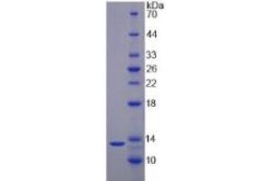 SDS-PAGE of Protein Standard from the Kit (Highly purified E. (IL17F Kit ELISA)