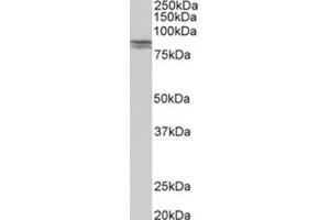 AP31777PU-N CDH1 antibody staining of Human kidney lysate at 0. (E-cadherin anticorps  (Internal Region))