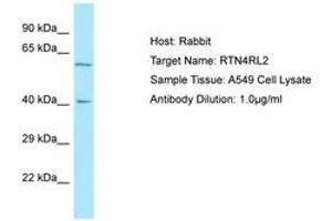 Image no. 1 for anti-Reticulon 4 Receptor-Like 2 (RTN4RL2) (C-Term) antibody (ABIN6750022) (RTN4RL2 anticorps  (C-Term))