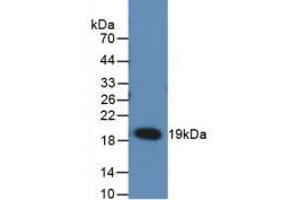 Western blot analysis of recombinant Rat RANkL. (RANKL anticorps  (AA 106-240))