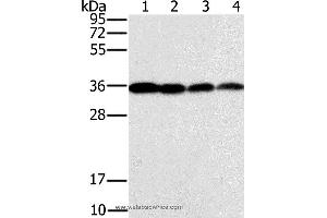 Western blot analysis of Raji, Jurkat, 293T and hela cell, using CENPV Polyclonal Antibody at dilution of 1:200 (CENPV anticorps)
