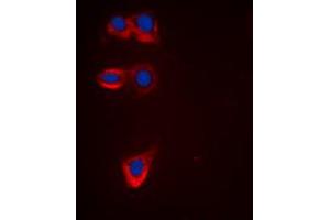 Immunofluorescent analysis of BCL2 staining in HeLa cells.