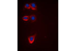 Immunofluorescent analysis of BCL2 staining in HeLa cells. (Bcl-2 anticorps  (Center))