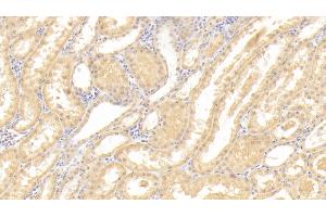 Detection of CASP3 in Human Kidney Tissue using Polyclonal Antibody to Caspase 3 (CASP3) (Caspase 3 anticorps  (AA 183-277))