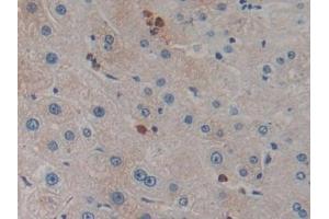 Detection of KLK10 in Human Liver Tissue using Polyclonal Antibody to Kallikrein 10 (KLK10)