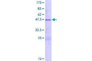 Image no. 1 for B-Box and SPRY Domain Containing (BSPRY) (AA 1-193) protein (GST tag) (ABIN1346909)