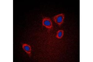 Immunofluorescent analysis of Caveolin 1 staining in A431 cells. (Caveolin-1 anticorps  (C-Term))