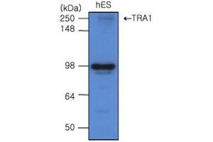 Western Blotting (WB) image for anti-Heat Shock Protein 90kDa beta (Grp94), Member 1 (HSP90B1) (AA 676-803) antibody (ABIN317570)