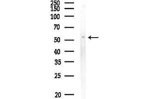 anti-gamma-aminobutyric Acid (GABA) A Receptor, Subunit beta 1 (GABRB1) (pSer434) antibody
