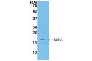 Detection of Recombinant S100A6, Human using Polyclonal Antibody to S100 Calcium Binding Protein A6 (S100A6)