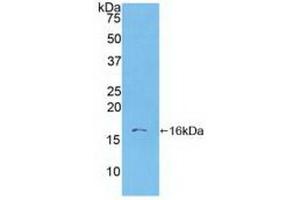 Detection of Recombinant S100A6, Human using Polyclonal Antibody to S100 Calcium Binding Protein A6 (S100A6) (S100A6 anticorps  (AA 1-90))