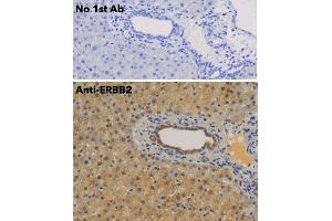 Immunohistochemistry (IHC) image for anti-Receptor tyrosine-protein kinase erbB-2 (ErbB2/Her2) (C-Term) antibody (ABIN6254225)