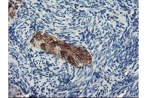Immunohistochemistry (IHC) image for anti-Dipeptidyl-Peptidase 8 (DPP8) antibody (ABIN1497835)