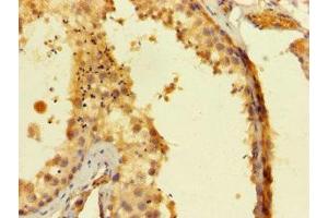 Immunohistochemistry of paraffin-embedded human testis tissue using ABIN7168583 at dilution of 1:100 (SAMSN1 anticorps  (AA 1-373))