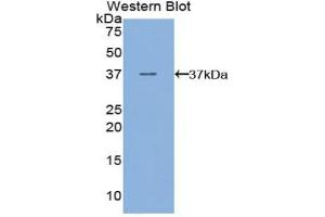 Western blot analysis of the recombinant protein. (FLT4 anticorps  (AA 30-326))