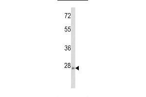 Western blot analysis of ARHE Antibody (Center)(Cat.