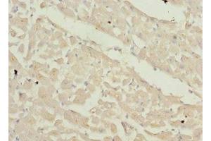 Immunohistochemistry of paraffin-embedded human heart tissue using ABIN7176063 at dilution of 1:100 (ZFYVE16 anticorps  (AA 1-280))