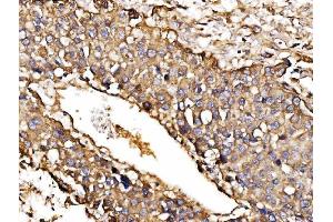 IHC analysis of ORP150/HYOU1 using anti-ORP150/HYOU1 antibody (ABIN7601807).
