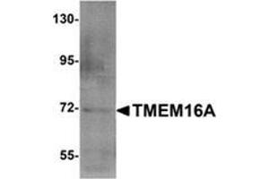 Western blot analysis of TMEM16A (arrow) in A549 cell lysate with TMEM16A Antibody  at 1 μg/ml. (ANO1 anticorps  (N-Term))