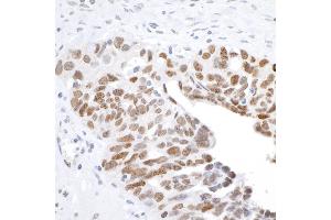 Immunohistochemistry (IHC) image for anti-H2A Histone Family, Member X (H2AFX) (C-Term) antibody (ABIN7449536) (H2AFX anticorps  (C-Term))