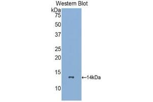 Western blot analysis of recombinant Human GCSFR. (CSF3R anticorps  (AA 26-138))