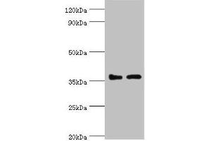 Western blot All lanes: BRCC3 antibody at 3 μg/mL Lane 1: 293T whole cell lysate Lane 2: MCF-7 whole cell lysate Secondary Goat polyclonal to rabbit IgG at 1/10000 dilution Predicted band size: 37, 34, 24, 29 kDa Observed band size: 37 kDa (BRCC3 anticorps  (AA 1-316))